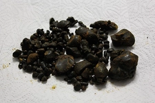 Karaciğerde Taş Belirtileri ve Tedavisi